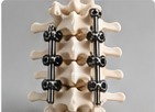 Spine solutions
