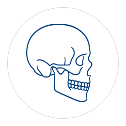 CMF Implants